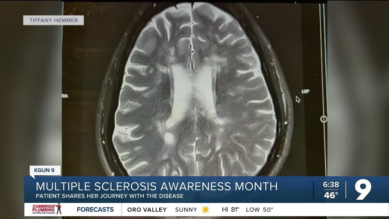 a-diagnosis-is-not-a-death-sentence-multiple-sclerosis-awareness