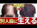 【必見】1日3分で薄毛を改善するプロ伝授の頭皮マッサージ