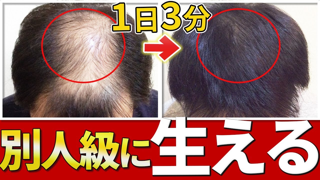 必見】1日3分で薄毛を改善するプロ伝授の頭皮マッサージ - YouTube