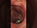 عملية هضم الطعام 