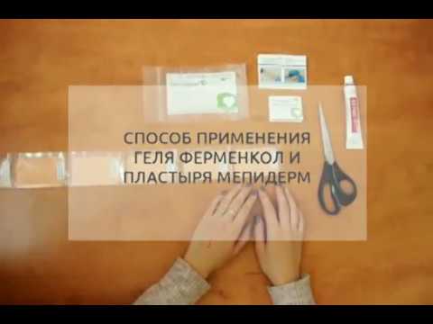 Способ применения геля Ферменкол и пластыря Mepiderm