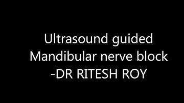 Ultrasound sound guided mandibular and maxillary nerve block