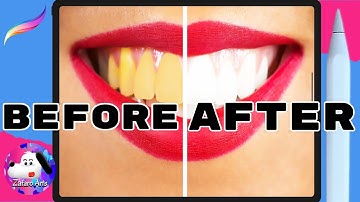 How to WHITEN TEETH in Procreate