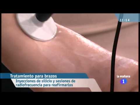 tratamiento para brazos gordos tratamiento para brazos gordos