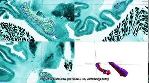 Hippocampal subfield revealed through unfolding and unsupervised clustering