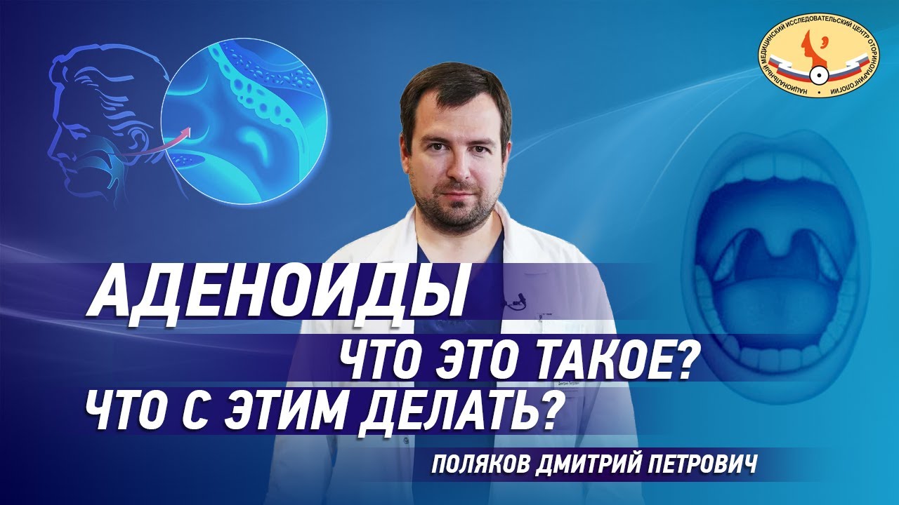 Аденоиды. Что это такое? Что с этим делать? Детская оториноларингология ...
