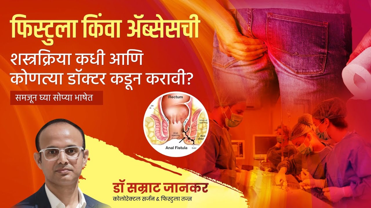 फिस्टुला किंवा ॲब्सेसची शस्त्रक्रिया करायची आहे? थांबा या गोष्टी चेक केल्याशिवाय करू नका
