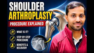 Arthroplasty of Shoulder Explained | Surgical Procedure Medical Coding Training