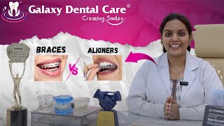 Braces Vs Aligners | Best Dental Hospital Clinic In Hyderabad