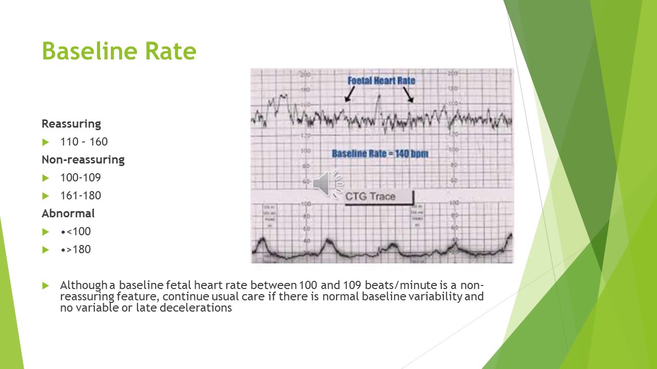 FHR interpretation - YouTube