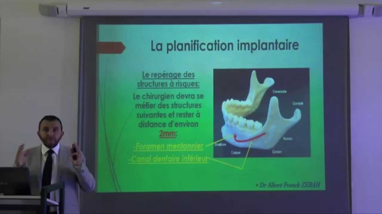 4ème commandement dentaire: la planification implantaire