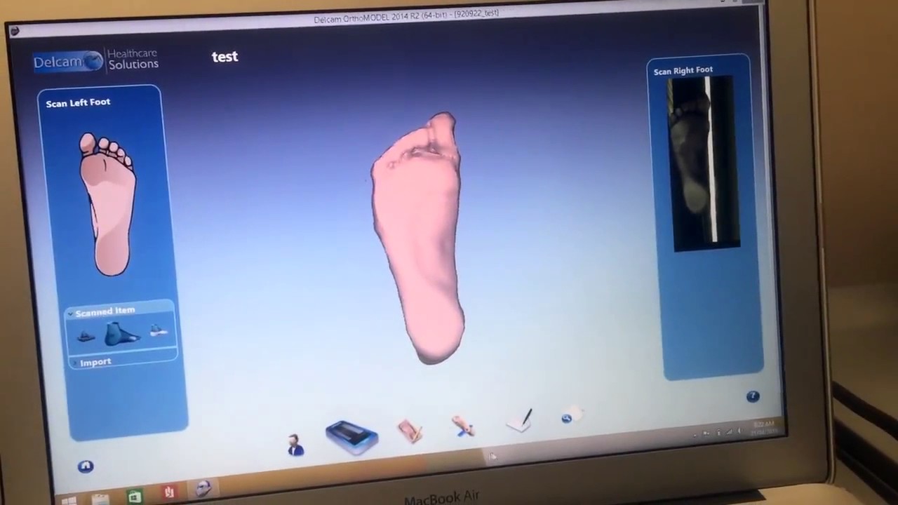 3D Laser Foot Scan for Custom Orthotics - YouTube
