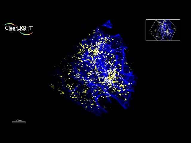 AACR 2022 Video Loop