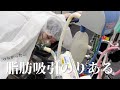 【脂肪吸引】辛すぎた脂肪吸引のりあるダウンタイムを公開！