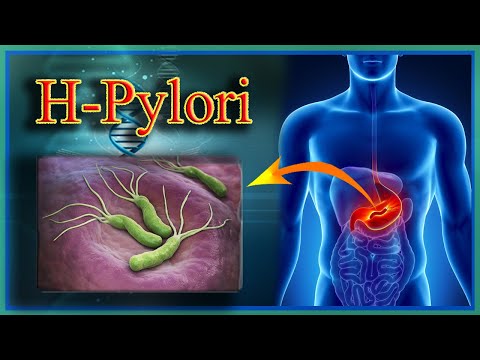 What is Helicobacter pylori? Helicobacter pylori is a gram-negative, microaerophilic bacterium commo. 