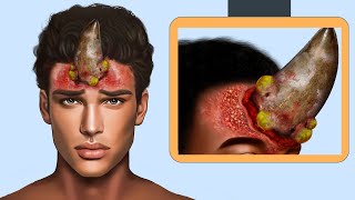 ASMR Remove Devil Horn & Worm Infected Dirty Head | Deep Cleaning Animation