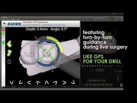 Intro Demo for