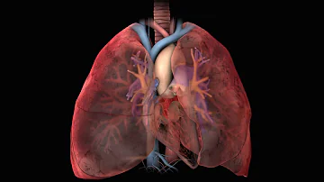 ¿Cómo se siente cuando su corazón está en fibrilación auricular?