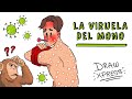 LA VIRUELA DEL MONO | Draw My Life