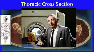 13-Anatomical Cross Sections of the Thorax Made Easy (13/13)