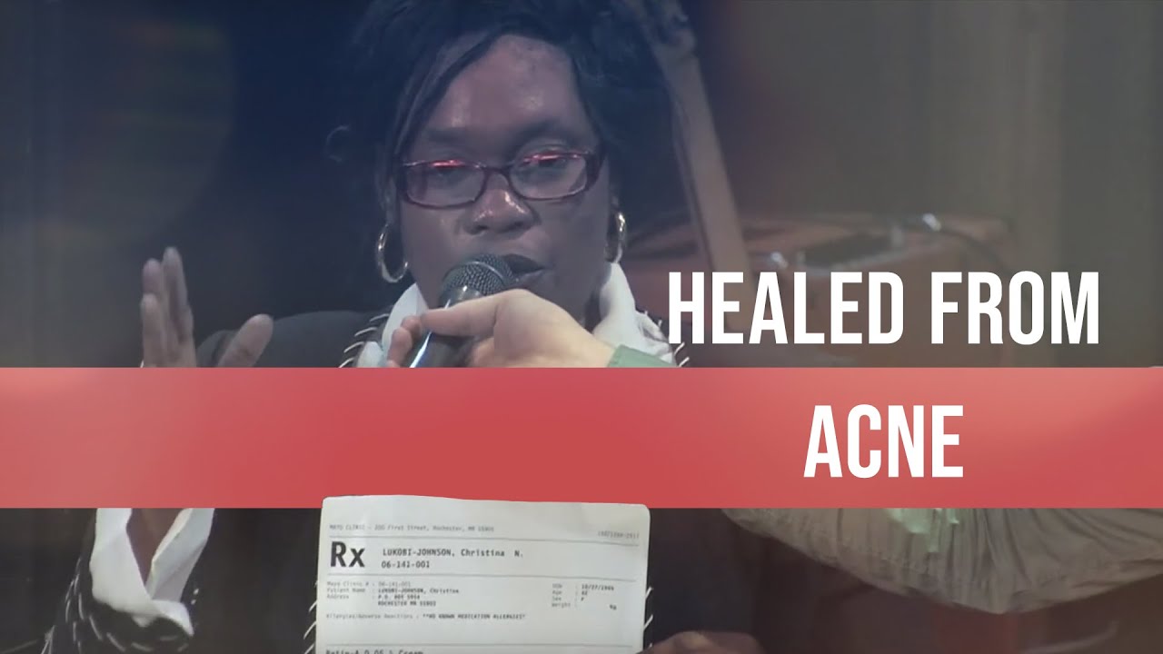 HEALED From Acne After Prayer YouTube