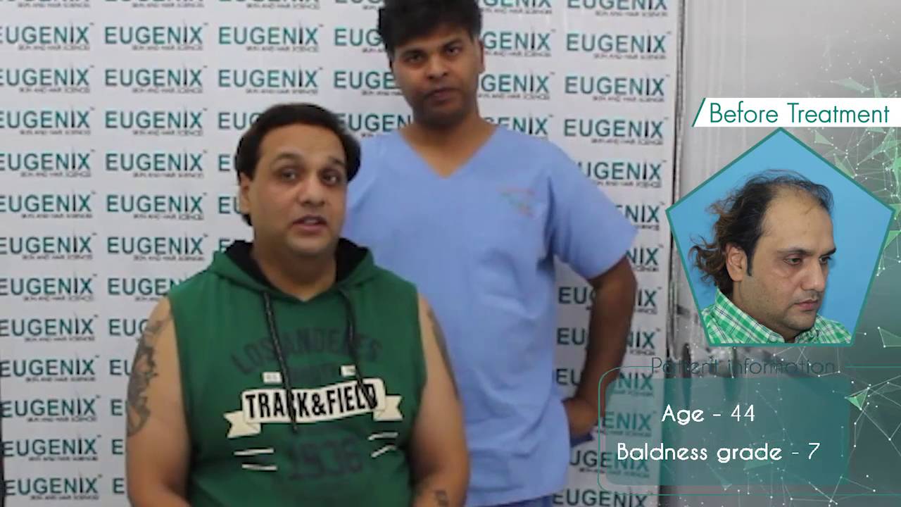 Wrong Hair Transplant Correction At Eugenix Hair Transplant Sciences