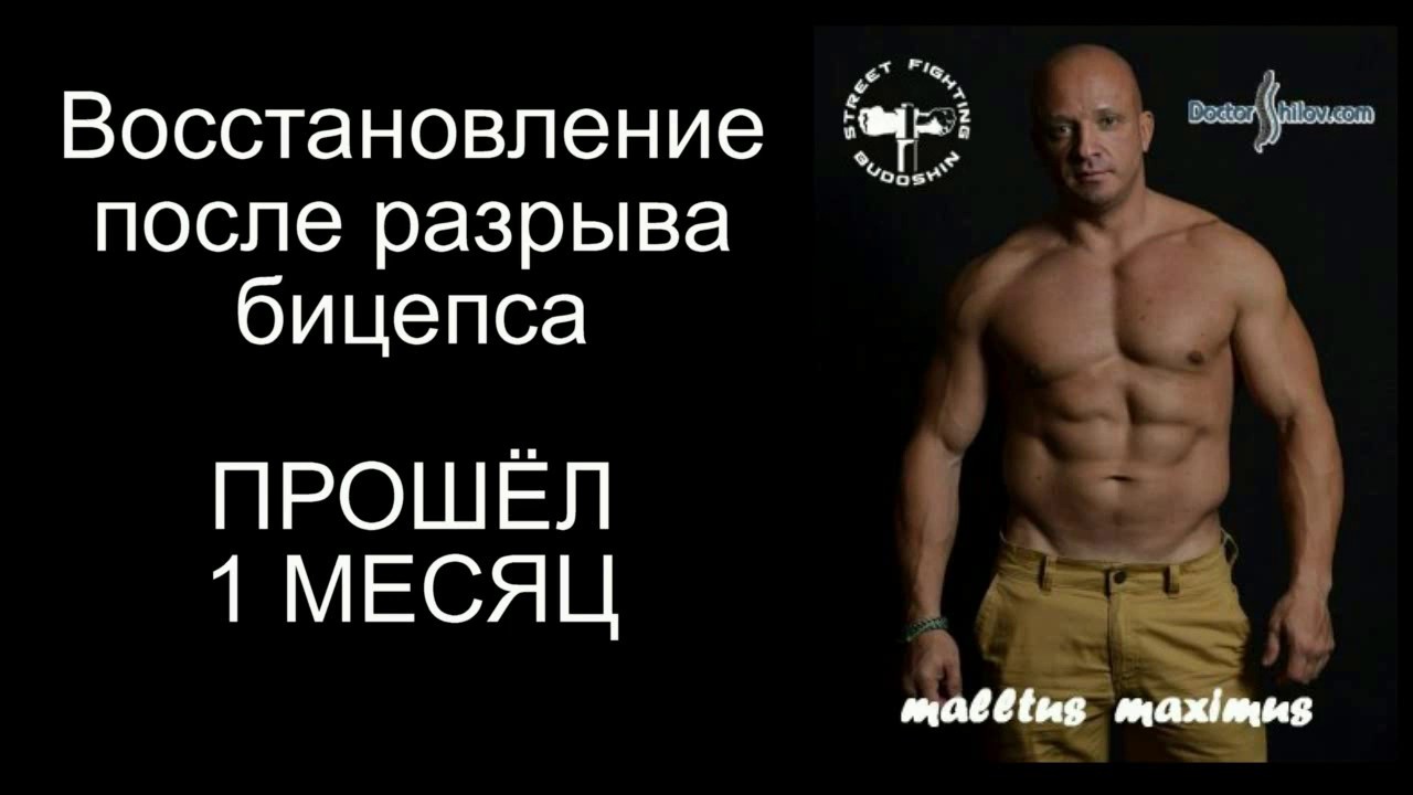 после отрыва бицепса