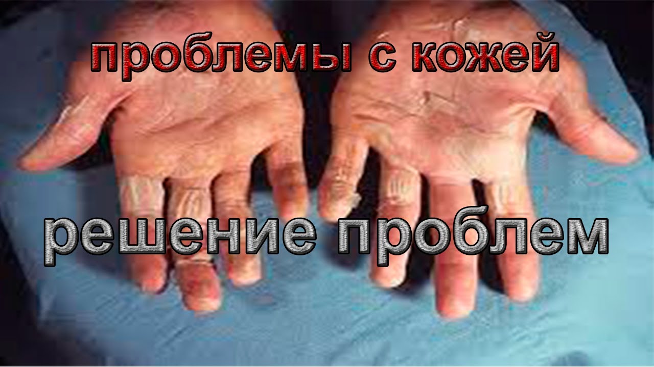 Проблемы с кожей рук. Результат применения виоргонов.