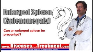 Enlarged Spleen (Splenomegaly): Can an enlarged spleen be prevented?