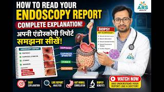 Read Your Endoscopy Report Yourself!अब अपनी एंडोस्कोपी रिपोर्ट खुद समझें