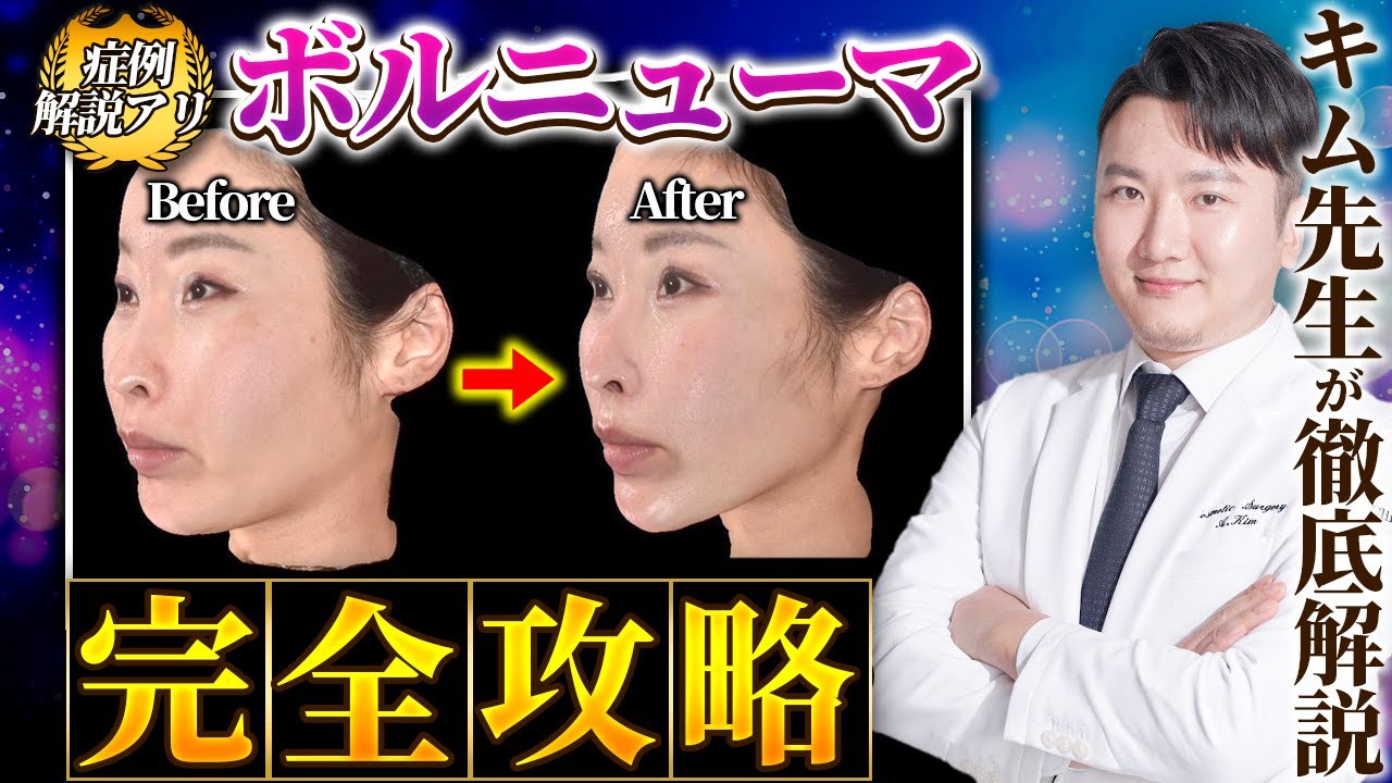 【韓国でも大流行】たるみ治療ならボルニューマ！効果やHIFUとの違いは？肌質も改善もできる！？