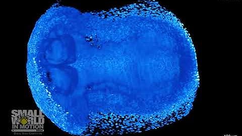 Developing Mouse Embryo, Showing the Progression of Neural Tube | 2019 Nikon Small World