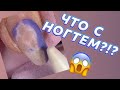 ЧТО С НОГТЕМ? 😱 КРУТОЕ ПРЕОБРАЖЕНИЕ