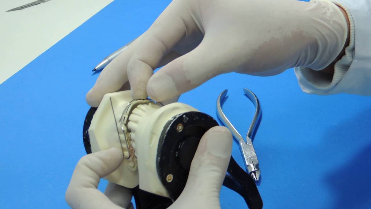 Dobra do bucinador sup