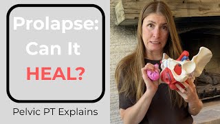 Prolapse: What It Is, What Helps, and How to Heal (Pelvic PT Explains)