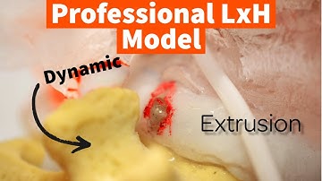 Product Video for the Professional LxH Dynamic Disc Model | Disc Herniation