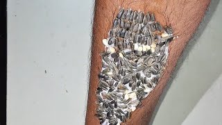 Live 🔴 Removing Pests One by One | Amazing Satisfying  Video - 