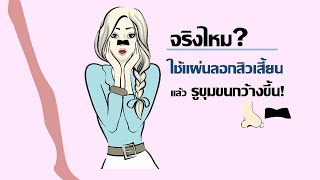 แผ่นลอกสิวหรือครีมลอกสิวทำให้รูขุมขนกว้างขึ้นจริงหรือไม่?