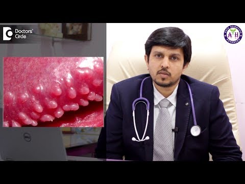 How to treat Pearly Penile Papules? - Dr. Sanjay Panicker