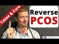 PCOS (What Causes PCOS) How to Reverse PCOS
