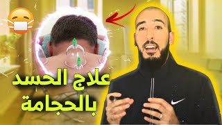 علاج الحسد عن طريق الحجامة بالتركيز على 6 أماكن فقط يتمركز فيها الحسد في جسمك قم بالحجم فيها لإخراجه