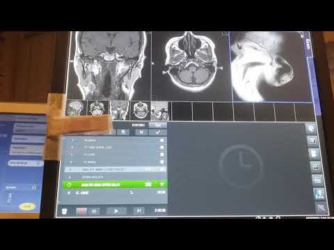 Video: MRI Sizning Itingizga Qanday Yordam Berishi Mumkin