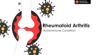 Rheumatoid Arthritis PowerPoint Presentation - Definition, Pathophysiology, Diagnosis and Management