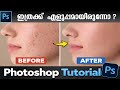 Photoshop Skin Retouching Tutorial Malayalam | Pro Editing Trick | Pixel Malayali