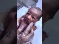 Cute Baby with NNJ in NICU 💛 | Neonatal Jaundice Care#cute #baby #neonatologist #babycare