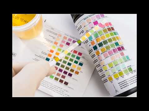 آزمایش آنالیز ادرار با ما همراه باشید تا نتایج مهمی درباره این آزمایش به شما بدهیم