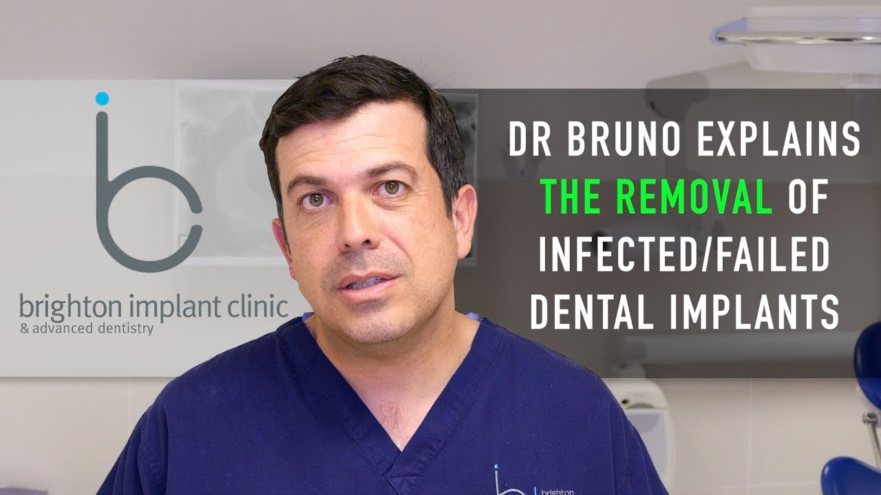 Removal Of Infected/Failed Dental Implant Allon4 Brighton Implant