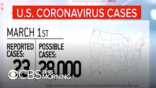 Celebrity New study says U.S. had coronavirus outbreaks before previously thought Profile