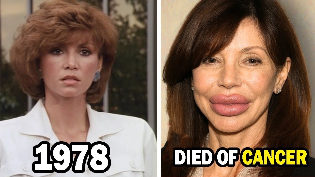 DALLAS (1978) – CAST THEN AND NOW (2026), Some Changes Will Shock You!