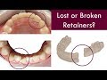 Have you LOST or BROKEN your Orthodontic Retainer?  |  Dr. Jiten Vadukul  |  The Orthodontist